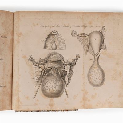 A treatise on the diseases of females, 1826, Prima edizione
