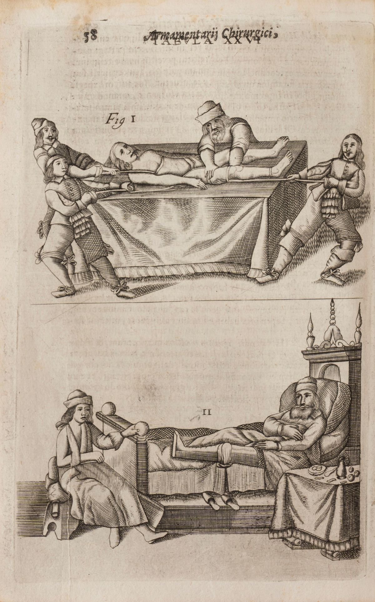 Johannes Scultetus - Armamentarium Chirurgicum