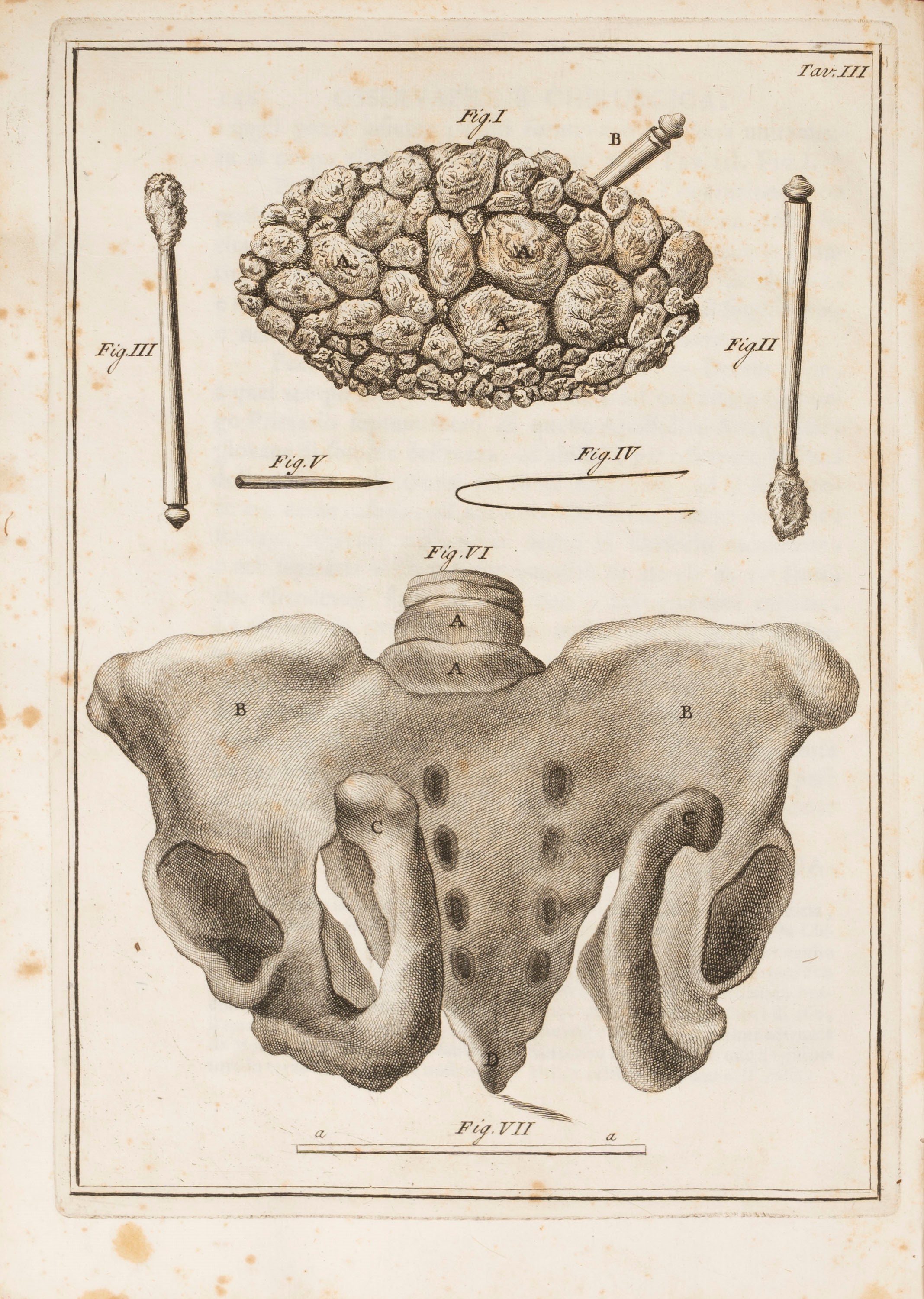 Giuseppe Flaiani - Nuovo metodo di medicare alcune malattie spettanti alla chirurgia, 1786