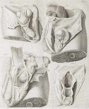 Sull'ernie memorie anatomico-chirurgiche