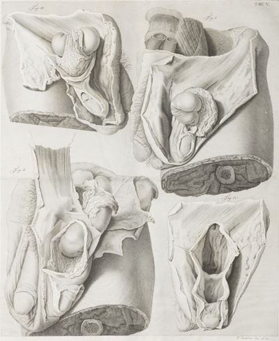 Sull'ernie Memorie Anatomico-chirurgiche