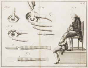 Delle cateratte con tavole in rame