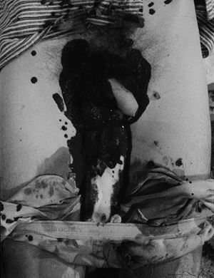 Nitsch Hermann - Action