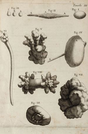 Lithotomy Or the Cavar la Pietra