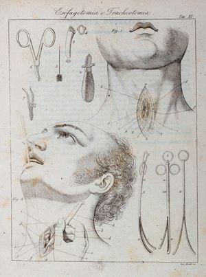 Girolamo   Fabrici  D' Aacquapendente  ,  Alfred Armand Louis  Marie Velpeau  - Opera chirurgica. Quorum pars prior Pentateuchum chirurgicum, posterior operationes chirurgicas contineOpera chirurgica 
