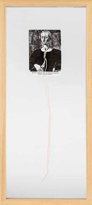 Il cordone ombelicale