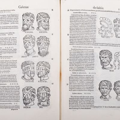 Galeni Omnia Quae Extant Opera.quorum Alia Nunc Primum Sunt Inuenta: Alia Vel Denuo Fidelius Tran...